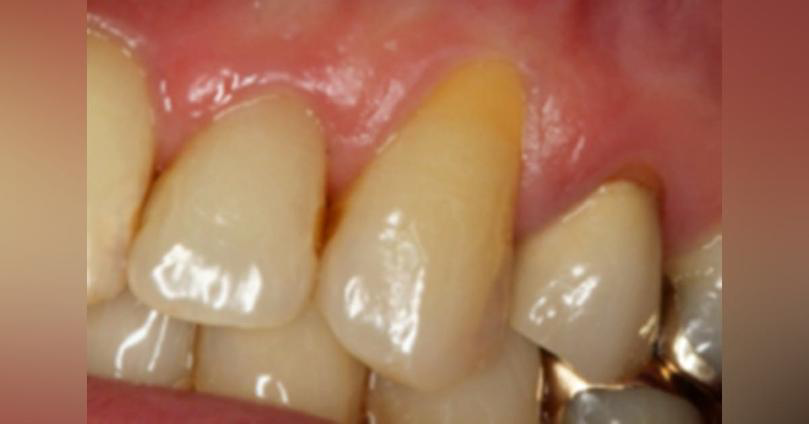 Raena AI